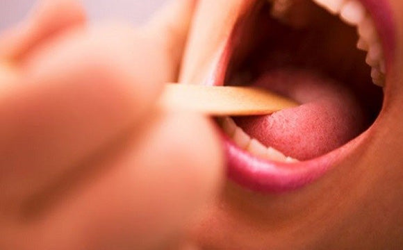 TEST ONE STEP STREP A DETERMINAZIONE QUALITATIVA ANTIGENI STREPTOCOCCO A IN TAMPONE FARINGEO AUTODIAGNOSTICO