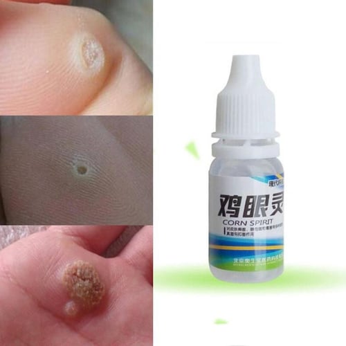 CALLIFUGO IN POMATA PER ESTIRPARE CALLI IGIENEPIEDE CONFEZIONE IN TUBO DA 5ML